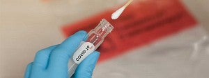 COVID-19 nasal swab laboratory test